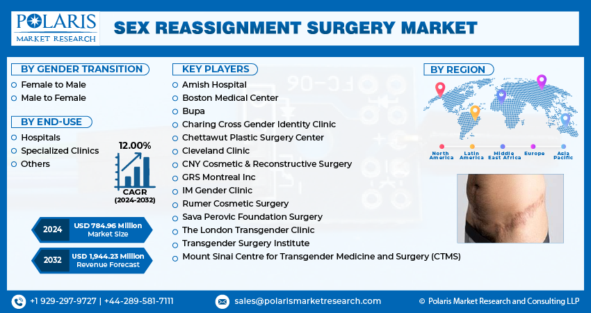 Sex Reassignment Surgery Market Growth And Trends 2032 1481